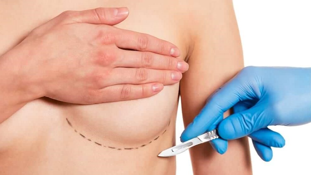 What Happens After Breast Implant Removal